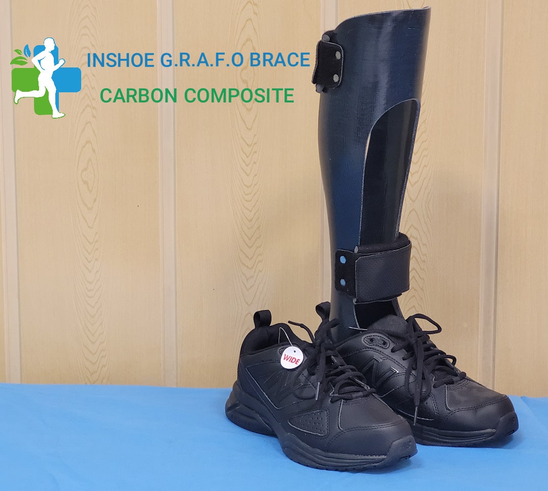 اسپلینت آفو