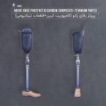 پای مصنوعی بالای زانو با سوکت کامپوزیت کربن (پروتز بالای زانو)