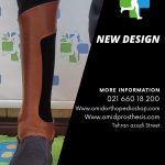 پای مصنوعی روی مچ با سوکت کامپوزیت کربن (پروتز کربنی سایم مچ پا)