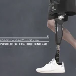 پروتز پا هوشمند (پا مصنوعی هوشمند)