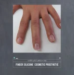 پروتز انگشت (انگشت مصنوعی سیلیکونی) - Image 4