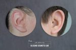 پروتز گوش (گوش مصنوعی سیلیکونی زیبایی) Cosmetic Silicone ear prosthesis - Image 2