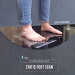 اسکن کف پا (Static foot scan)