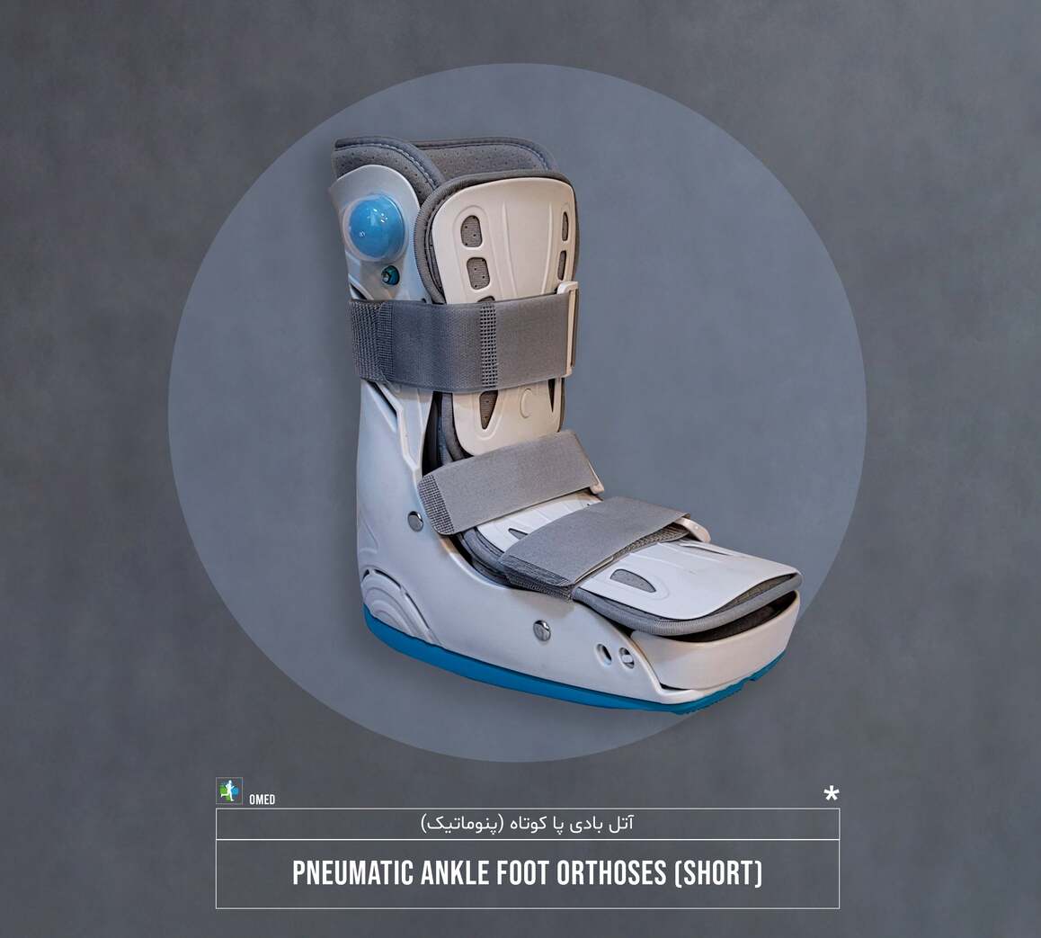 IMG_20250126_003401_861-min (1)-min ایرکست کوتاه