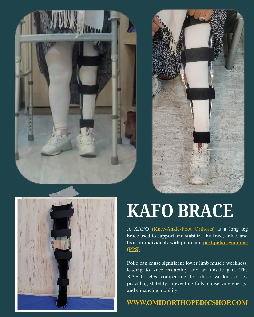 بریس kafo