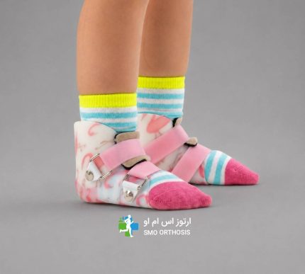smo splint