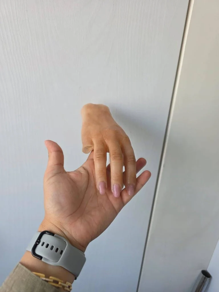 نمونه دست مصنوعی ساخته شده امید شاپ